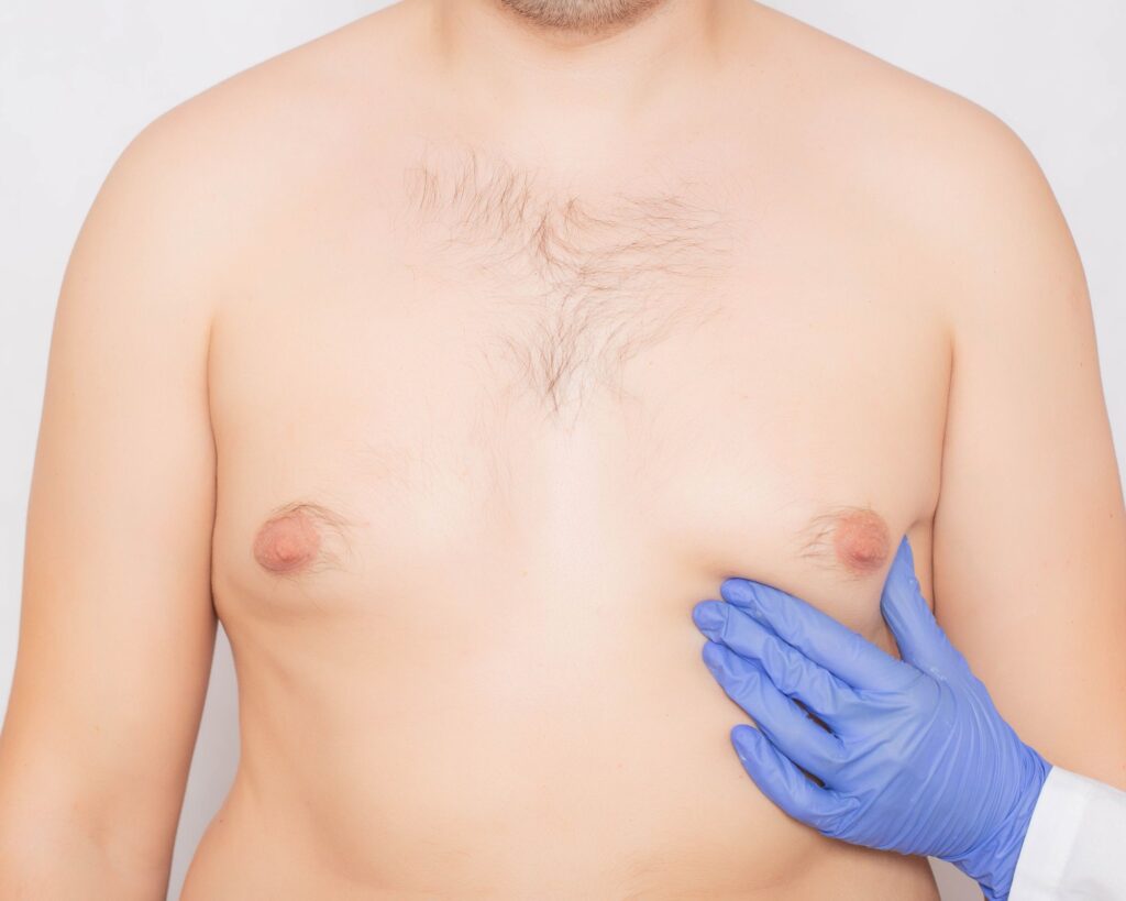 A Man&#8217;s Guide to Understanding and Managing Large Breasts and Inverted Nipples